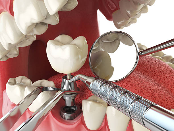 Best Tooth Infection Emergency Dentist  in Ashland, MO